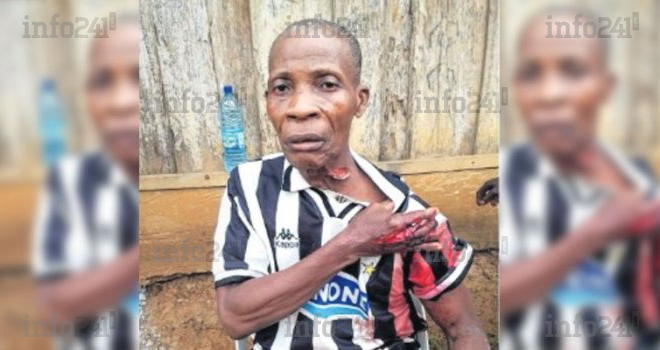 Kango&nbsp;: Venu pour séparer une altercation, un septuagénaire récolte des coups de machette