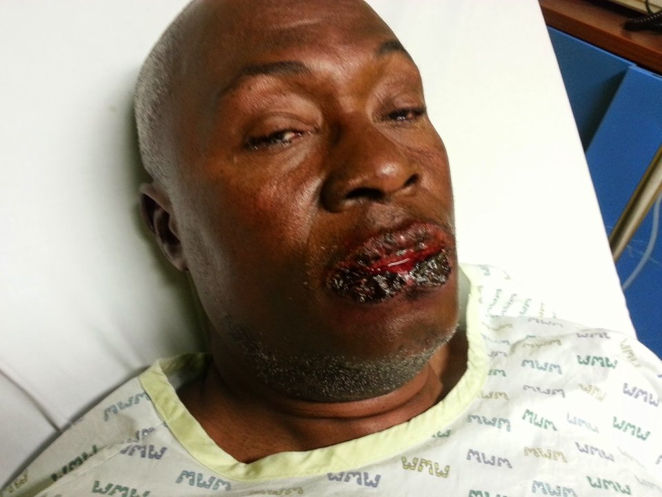 Les images de &laquo;&nbsp;l’empoisonnement&nbsp;&raquo; de sieur Iwangou dateraient de l’année dernière